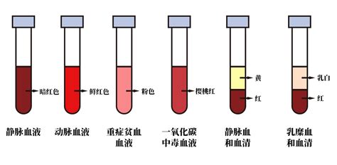 血乾掉的顏色|血干了是什么颜色？这是血么？